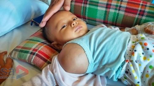 Lengan Membengkak, Bayi 4 Bulan di Sidimpuan Butuh Biaya Berobat