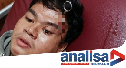 Sadis! Gegara Asmara, Pemuda di Sidimpuan Tancapkan Gunting ke Kepala Rekannya