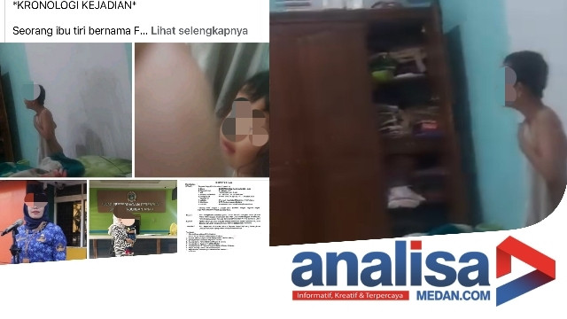Video Anak Korban Penyiraman Air Panas, Pelaku Diduga Ibu Tiri Yang Bertugas di Dinas Perlindungan Anak