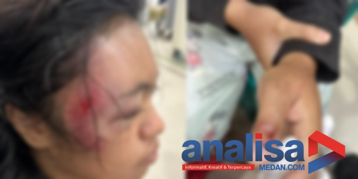 Wanita Muda di Sidimpuan Jadi Korban Begal. Dianiaya, Diperkosa Dan Varionya Dilarikan